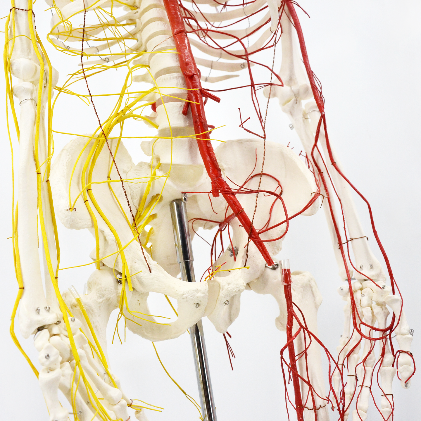 170CM neurovascular bones
